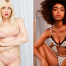 Lingerie-campaign-launched-starring-women-with-body-hair-and-scars2